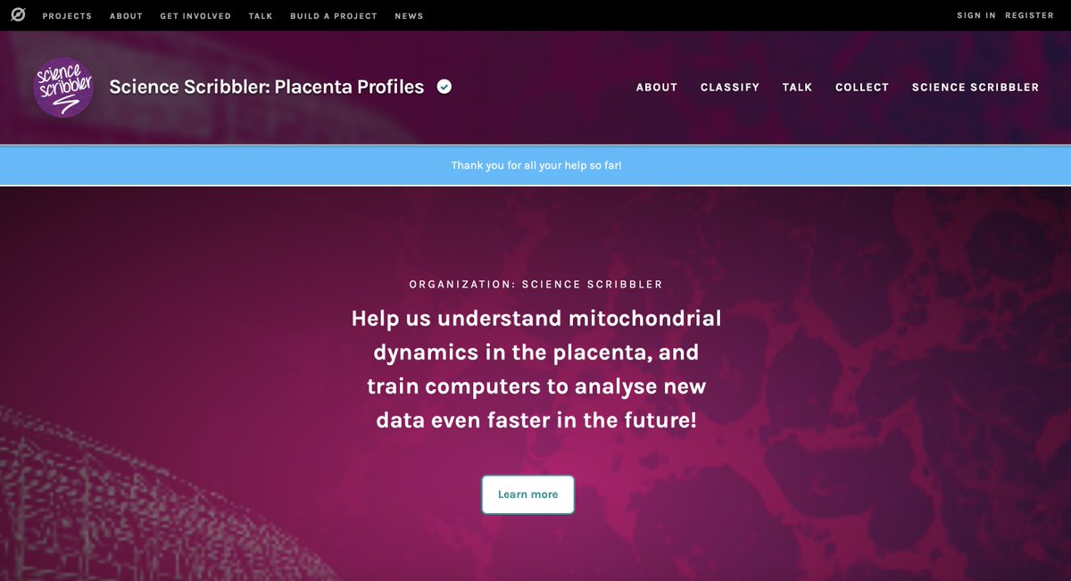 Jodie Deinhammer (@jdeinhammer) on Twitter photo Anatomy classes contributed 3 hours of #CitizenScience for <a href="/SciStarter/">SciStarter</a> on <a href="/the_zooniverse/">The Zooniverse</a> analyzing placenta samples #OneMillionActsofScience zooniverse.org/projects/msbrh… Anatomy classes contributed 3 hours of #CitizenScience for <a href="/SciStarter/">SciStarter</a> on <a href="/the_zooniverse/">The Zooniverse</a> analyzing placenta samples #OneMillionActsofScience zooniverse.org/projects/msbrh…