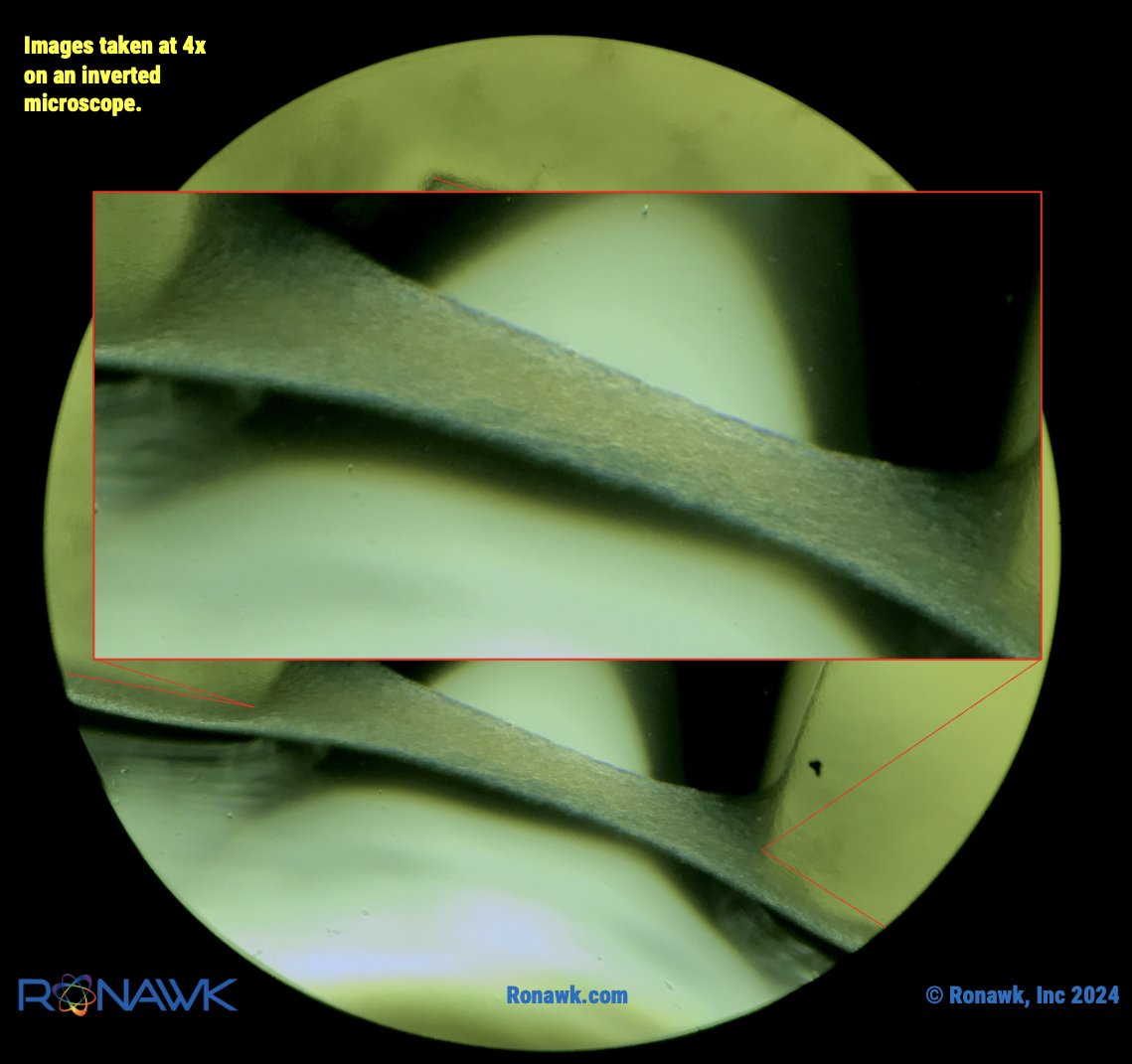 Return of the Bridges of Adipose Stem Cell County!  4 days in culture & cells are FREE to create structures that mimic tissue. What would you do with that? Lets collaborate, email us at info@ronawk.com.

#adiposestemcells, #cellculture, #tissueengineering, #mesenchymalstemcells