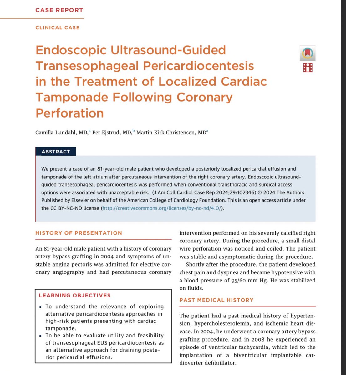 Out in @JACCJournals #casereports: 

Endoscopic Ultrasound-Guided Transesophageal Pericardiocentesis in the Treatment of Localized Cardiac Tamponade Following Coronary Perforation @AalborgUH 

sciencedirect.com/science/articl…