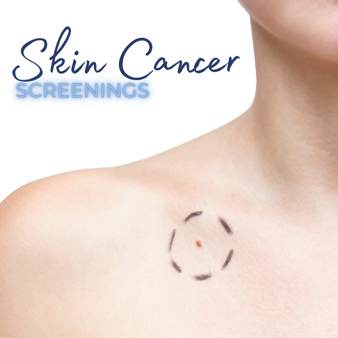 Skin cancer screenings save lives. Prioritize your health with our thorough screenings and expert care. Early detection makes all the difference!

 #SkinHealthFirst #CancerScreening #PreventiveCare