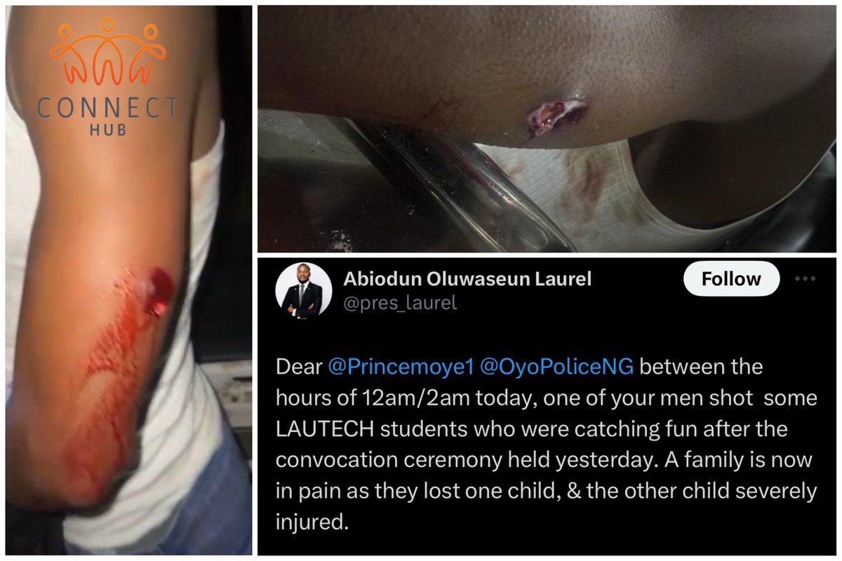 Officers of @policeng opened fire on LAUTECH students during post-convocation celebrations. One student lost their life, while another is critically injured. 

These families are now devastated due to the abuse of power by policemen. 

#endpolicebrutality 
#hubngr