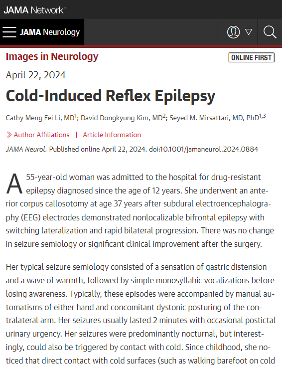 Case report: describes a woman cold-induced reflex seizures. ja.ma/4aK9qId