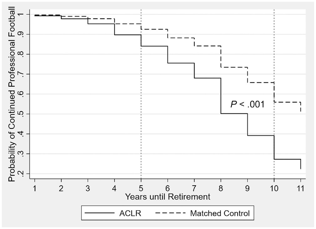 ACL Reconstruction shortens the career of #EnglishPremierLeague #Soccer players by an average of 1.6 years! ow.ly/FjYC50RkKtX