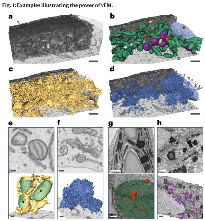 🦾🔬The power of vEM: From bone cells, mitochondria, nuclear envelopes, peroxisomes, lysosomes, endoplasmic reticulum, and Golgi complex: vEM enables analyses and visualisation. Check out this paper showing examples of vEM in cell biology: lnkd.in/eDSbiuFr