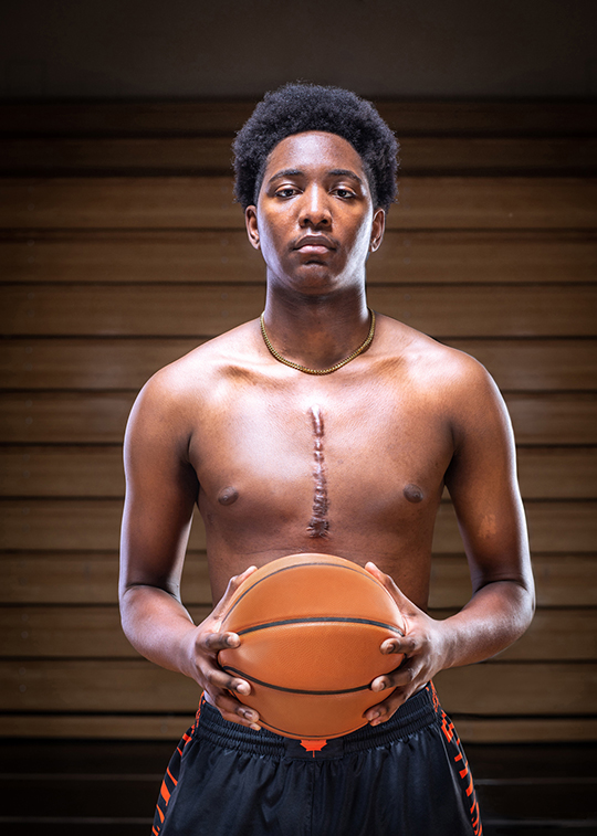 During National Organ & Tissue Donation Awareness Week (April 21-27), we want to recognize the story of Dylan Kalambay, a young basketball player who returned to the court thanks to a life-saving heart transplant 💚 Watch Heart and Sole here: learn.organtissuedonation.ca/en/film-heart-…