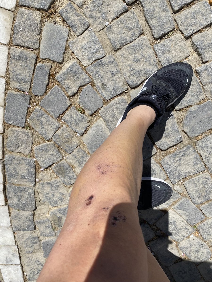 @ceydakbulut8 Paris Roubaix yaraları geride kaldı. Bisikletten kalan tüm yara bereler bir rütbe&arma gibi. Zayıflığınızı hatırlatıp, öğrenip, geleceğe daha büyük iştahla ve umutla bakmayı sağlıyor. Prolar zaten yarı tanrı insanlar. Onların yanında hobbit sanrılarımız var sadece.