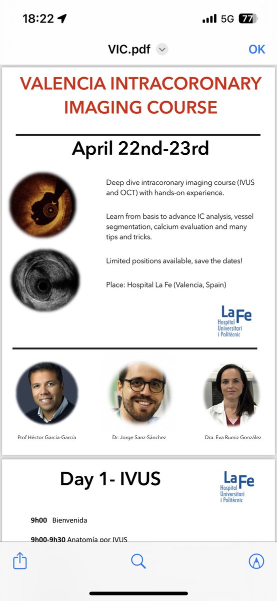 Two intensive days of Intracoronay imaging course with tons of learning and 2 live cases including @VulnerableTrial Many thanks to all! @hect2701 @EvaRumiz @Jp_vilchez @josepgomezlara @JL_10_HILL @HemodinamicaFe