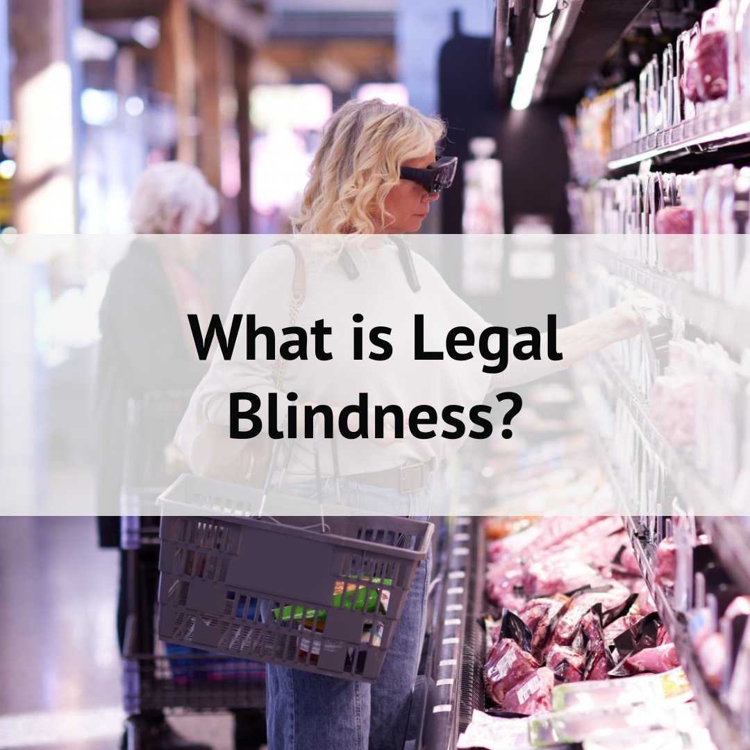 Legal blindness is a term that applies to people with a specific threshold of visual impairment (20/200 vision). Notably, legal blindness is not the same as total blindness where a person cannot see anything at all. esighteyewear.com/vision-loss/le… 

#eSight #VisionLoss #LegallyBlind