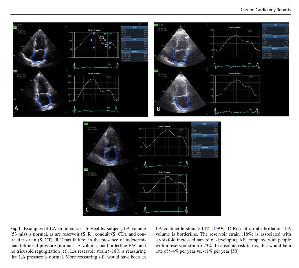 Evolving Applications of Echocardiography in the Evaluation of Left Atrial and Right Ventricular Strain doi.org/10.1007/s11886… #echofirst #CardioEd #cardiotuiteros #CardioTwitter