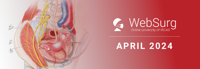 WebSurg April 🔍focus - Gynecologic surgery
➡️bjsacademy.com/new-partnershi…

🌐Continuing our partnership with IRCAD and Websurg, we bring you April's focus of the month🚀

#LeadingSurgicalEducation #EducationForAll #SoMe4Surgery @young_bjs @websurg