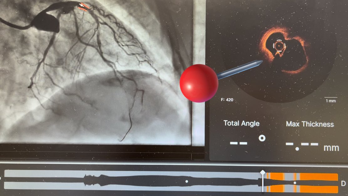 What do you see 📌❓ Hint: this is not a bifurcation