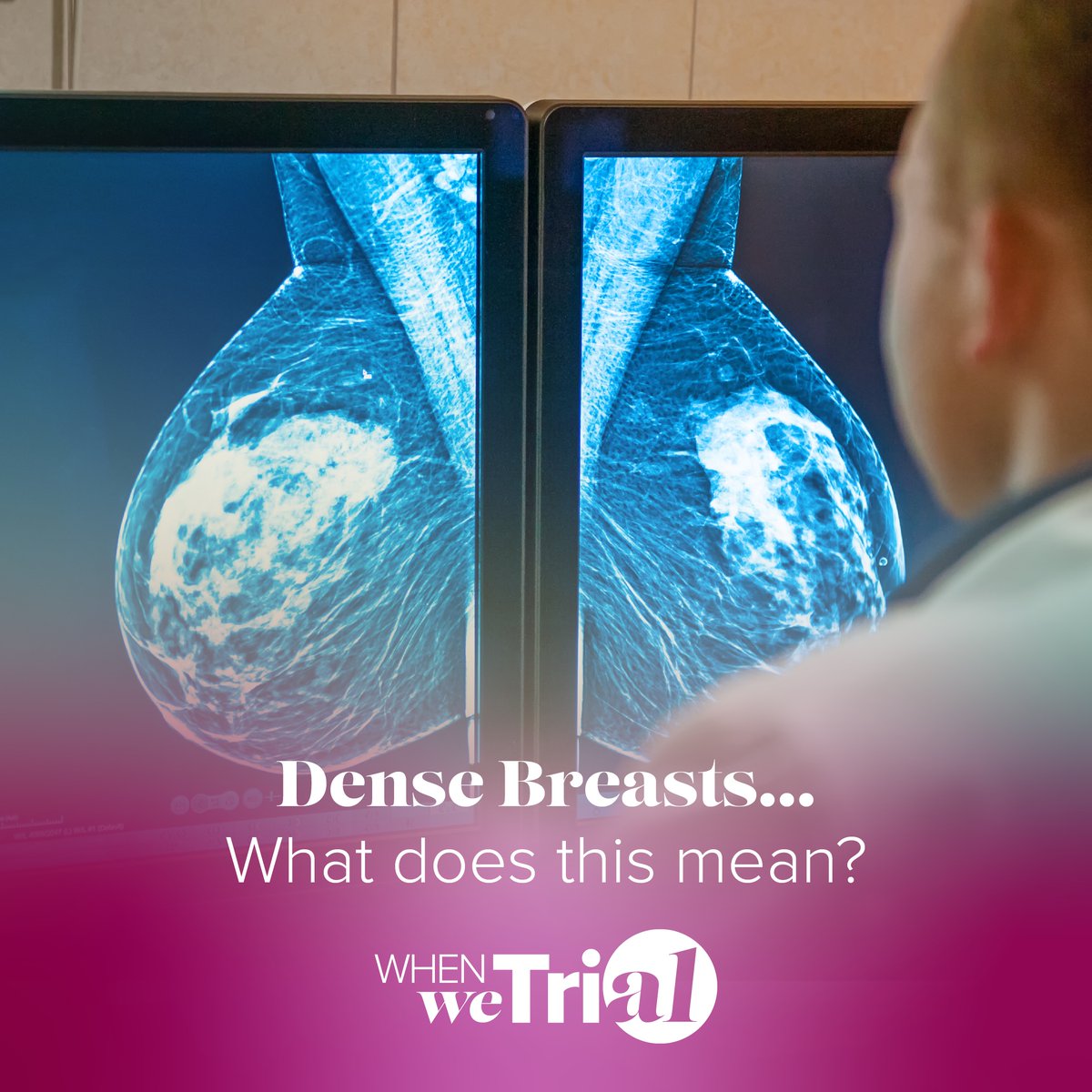 Most Black women, especially at younger ages, have dense breasts. Dense breast tissue cannot be felt—only a radiologist looking at a mammogram can tell if a woman has dense breasts, and 3D mammograms are best for finding early signs of breast cancer in women with dense breasts.