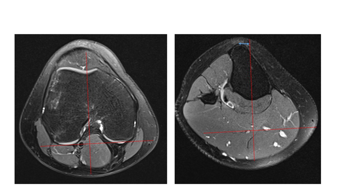 Per-Henrik Randsborg tweet media