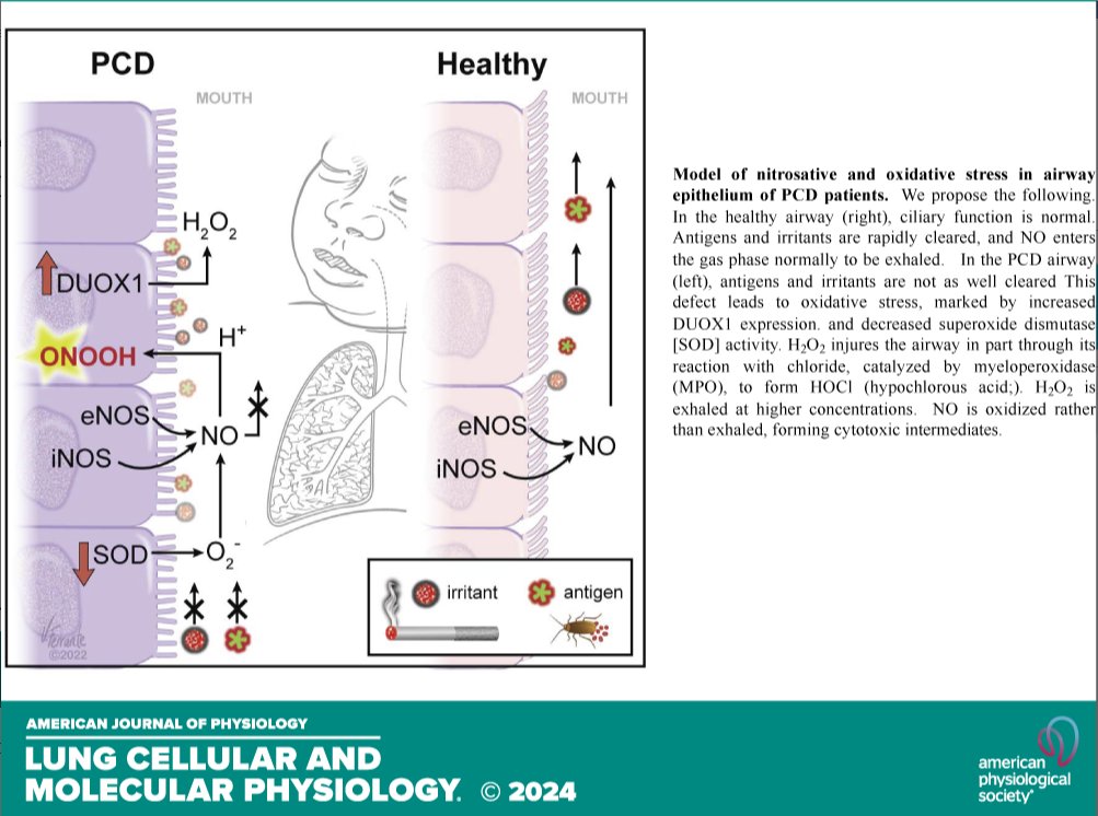 AJPLung's tweet photo. Today's new issue highlight isn't only an #OpenAccess piece but an APS Select article! Antigen stasis and airway #nitrosative #stress in human primary ciliary dyskinesia (Benjamin Gaston et al. @IUMedSchool):
https://t.co/BWZVLqA8IV https://t.co/Rv6GJGXdOw
