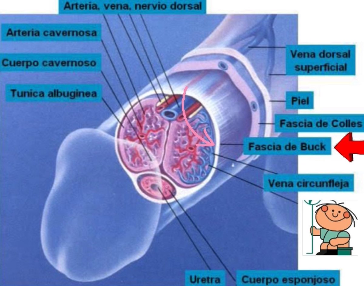 siupurol's tweet photo. 💎En relación a la pregunta del día anterior:

📍La respuesta correcta: * d *

✅ La fascia de Buck es la estructura que contiene el sangrado 🩸 derivado de una fractura ⛓️‍💥de pene, FB rodea ambos cuerpos cavernosos y el cuerpo esponjoso. 🧵 1/2 ���️👇 https://t.co/06HDbnNH9k