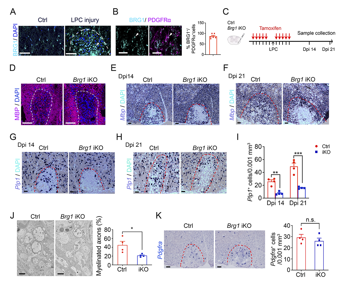 Wang, Lu et al. @CincyChildrens demonstrate the critical role of BRG1/SMARCA4 for #oligodendrocyte precursor cell differentiation and remyelination hubs.la/Q02tPfbS0