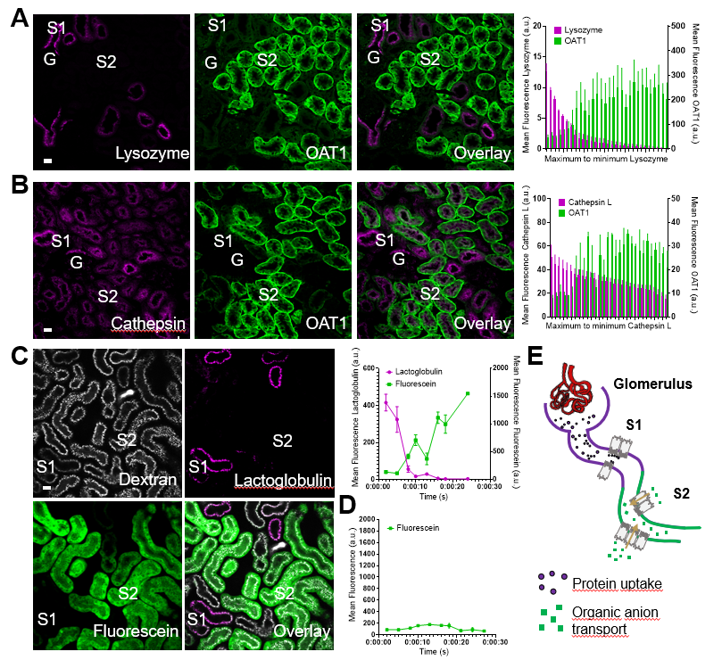 Large increases in glomerular protein filtration increase risk of kidney functional decline and cardiovascular disease. This study found proteinuria modulated cell signaling in tubular epithelia and causes distinct patterns of remodeling and injury bit.ly/JASN0357