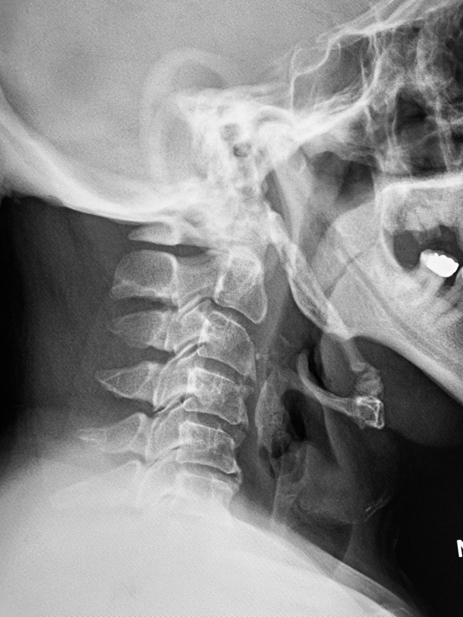  William Morrison, MD tweet media