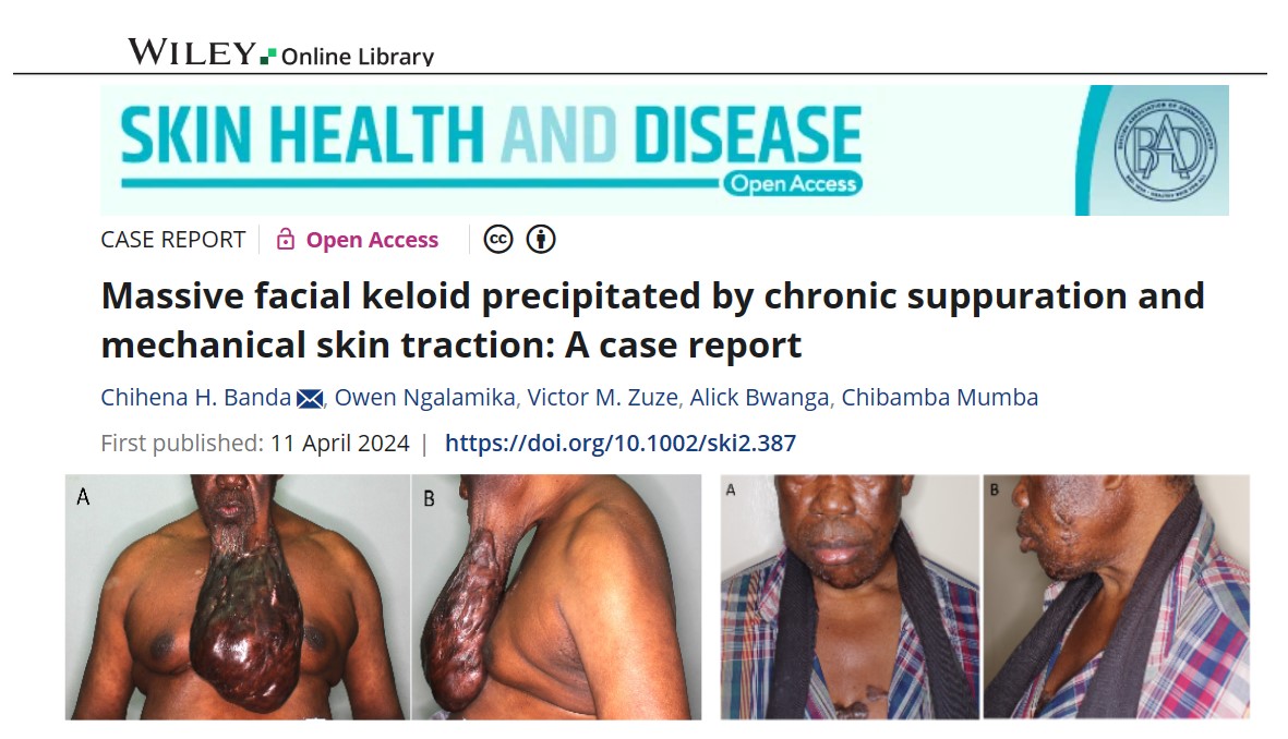 Chihena Banda M.D., PhD tweet media