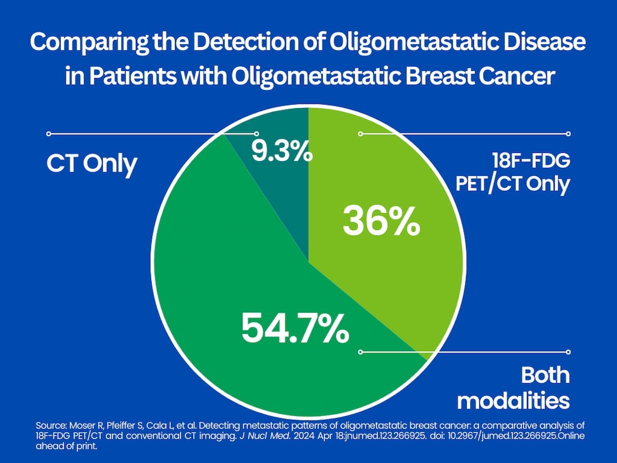 PET/CT Shows Superior Results Over CT for Detecting Oligometastatic #BreastCancer diagnosticimaging.com/view/pet-ct-su…
@ACRRFS @ACRYPS @RadiologyACR @ARRS_Radiology @RSNA @BreastImaging @SNM_MI @DukeRadiology @PennRadiology @MontefioreRAD @YaleRadiology @UABRadiology 
#radiology #RadRes