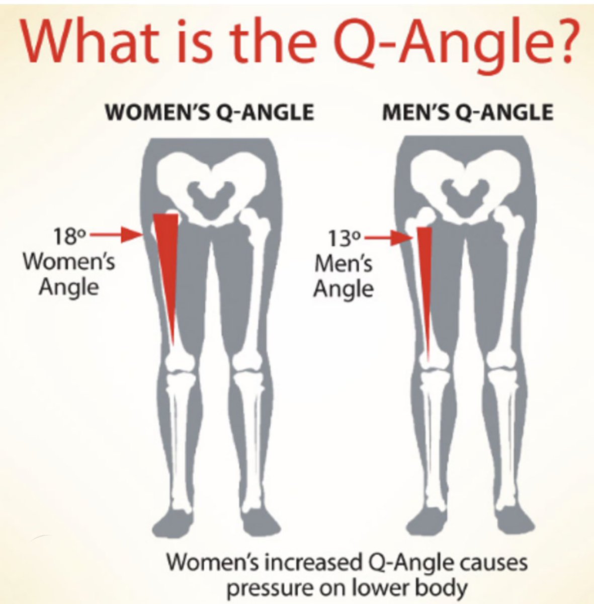 sharrond62's tweet photo. This Q angle causes 3-6x as many knee (often ACL) injuries in females in football alone. A narrower angle allows better leg power in running & cycling to name just two sports. Along with being taller, having bigger hands, males are much more explosive athletes - great in goal. These things are not effected by reducing testosterone which every peer reviewed study proves doesn’t remove all male physical advantage. And there’s NO independent testing either, to level 5 or 10 times female levels! We have separate female/male categories to offer equal opportunities to both sexes. Along with age & weight categories. Stop going along with sex discrimination in sport. Start saying NO more.