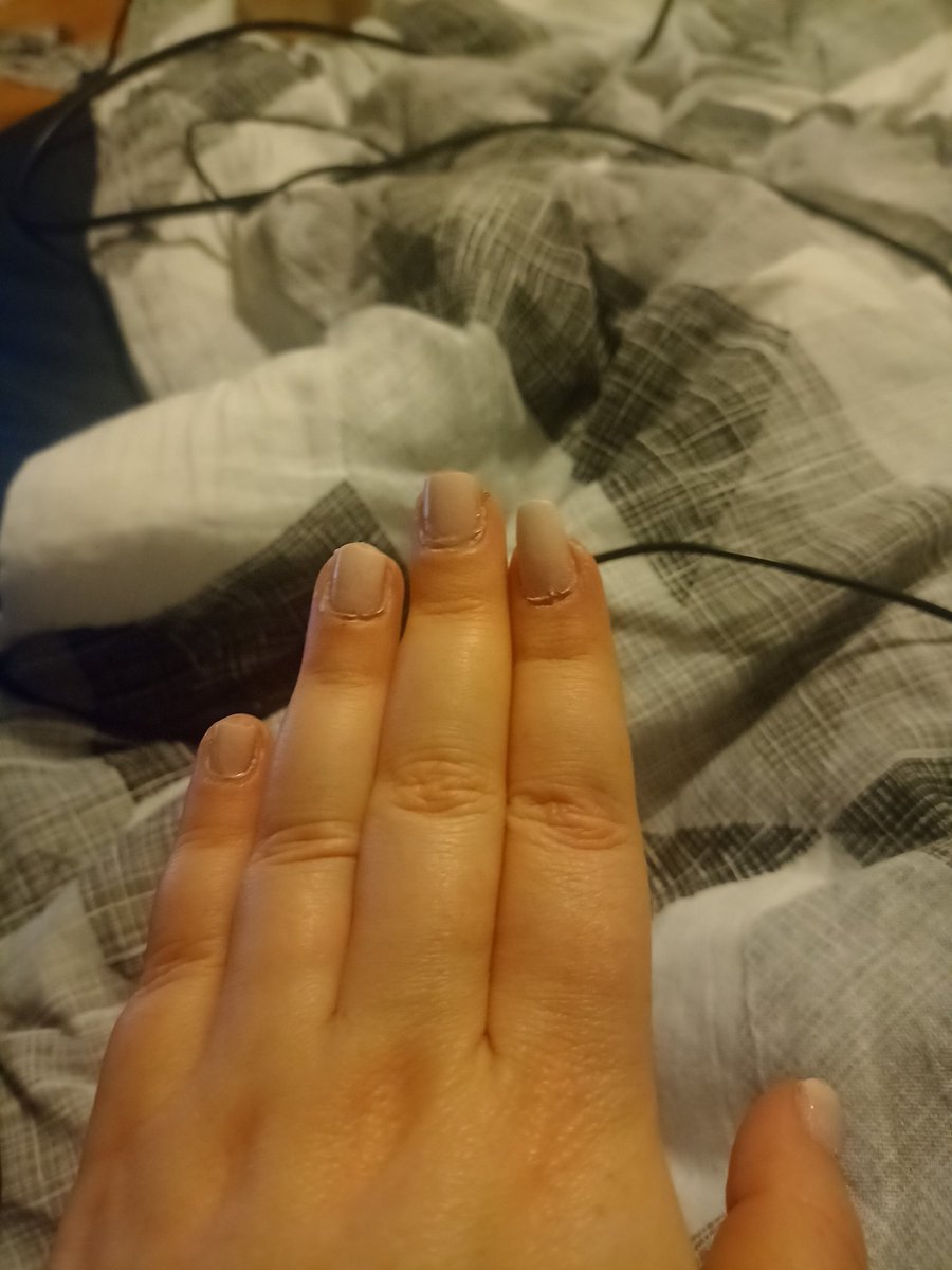 aprilsfool_92's tweet photo. When you're pretty stressed out because you were having a minor fight with your boyfriend and rip all of your nails off https://t.co/VMNBxni04r