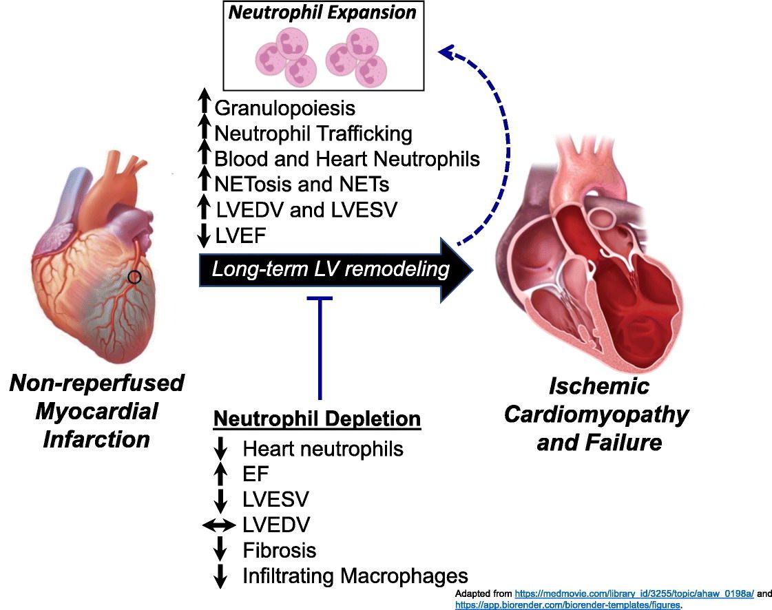 From our Special Issue on #cardioimmunology, research shows Neutrophils are indispensable for adverse cardiac remodeling in heart failure: buff.ly/49Ki9c0 @k8weeks @vagnozzirj @PilarAlcaidePhD @monikagladka @ELS_Cardiology