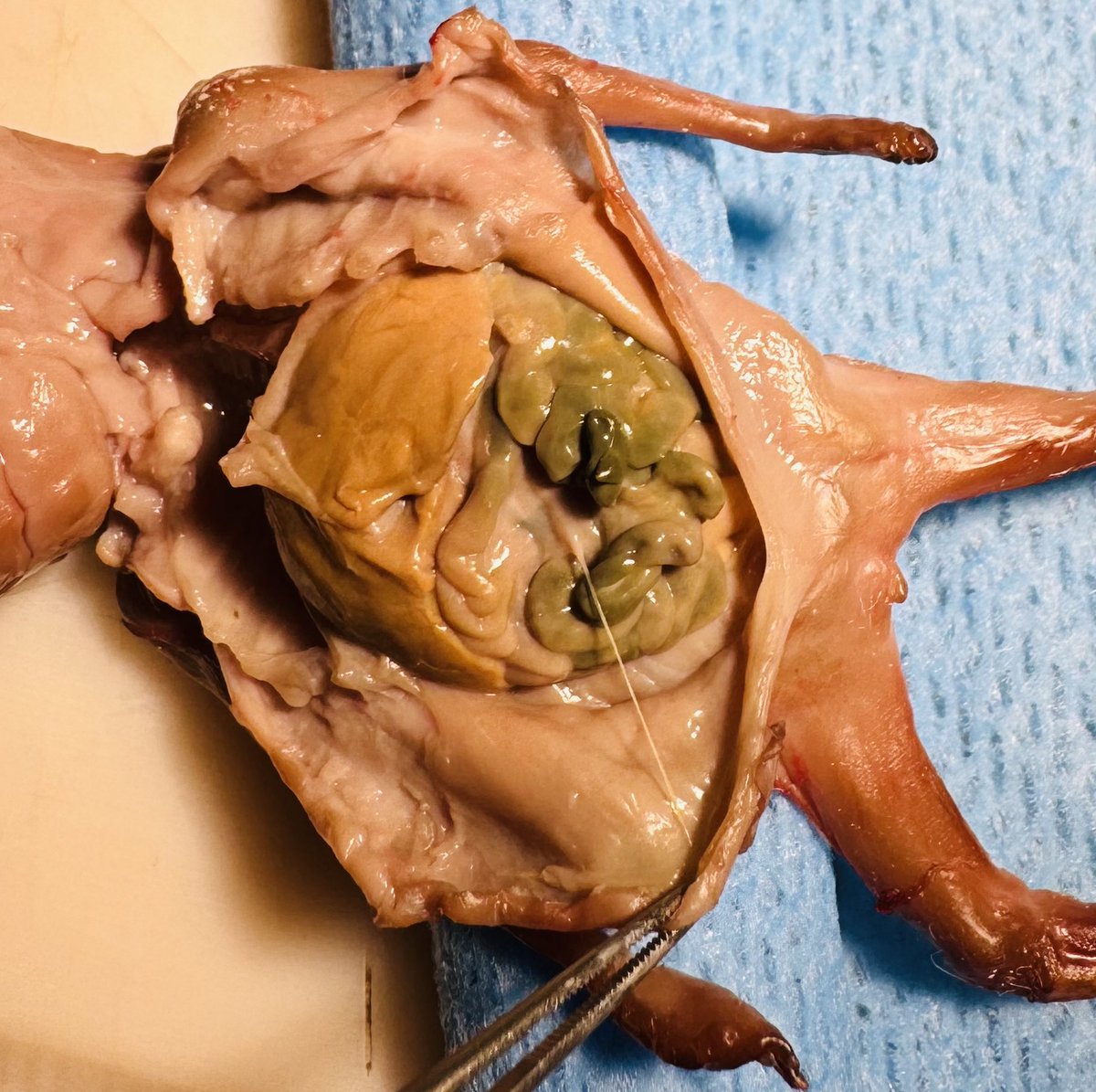 IUFD for long long time (>several weeks) what are we seeing here?
#perinatal #autopsy #pedipath

PS: someday #PathTwitter need a review of maceration sign for our clinicians as I’ve seen attempts to resuscitate an IUFD >4-7 days