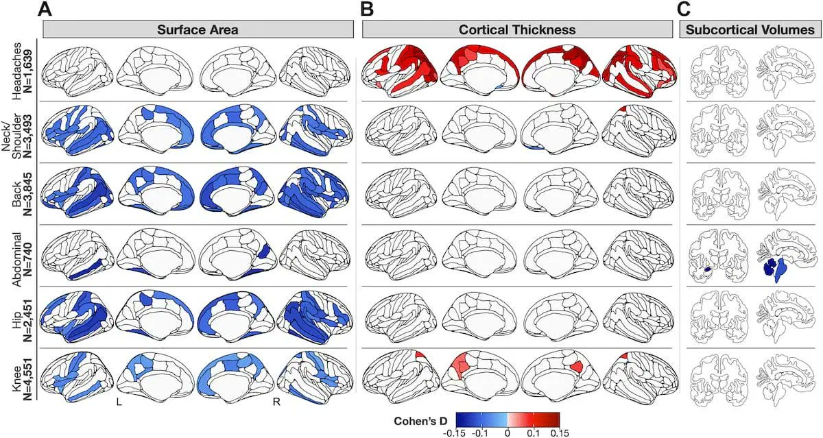 Lab of Neuro Imaging (@uscloni) on Twitter photo 🧠 Learn all about the largest brain imaging study of chronic pain to date from <a href="/njahanshad/">Neda Jahanshad</a> <a href="/ravirbot/">Ravi R. Bhatt</a>!
The study pinpoints differences in gray matter in those with chronic pain compared to healthy individuals
👉 bit.ly/4aLXXYp 🧠 Learn all about the largest brain imaging study of chronic pain to date from <a href="/njahanshad/">Neda Jahanshad</a> <a href="/ravirbot/">Ravi R. Bhatt</a>!
The study pinpoints differences in gray matter in those with chronic pain compared to healthy individuals
👉 bit.ly/4aLXXYp