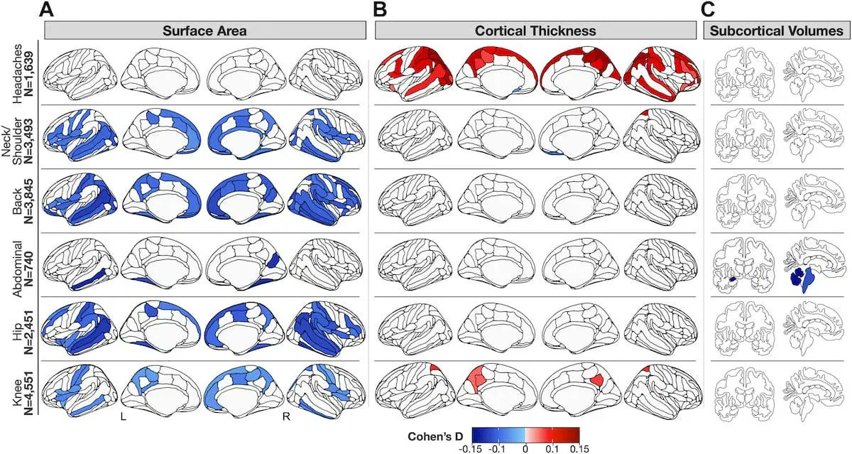 🧠 Learn all about the largest brain imaging study of chronic pain to date from @njahanshad @ravirbot! The study pinpoints differences in gray matter in those with chronic pain compared to healthy individuals 👉 bit.ly/4aLXXYp