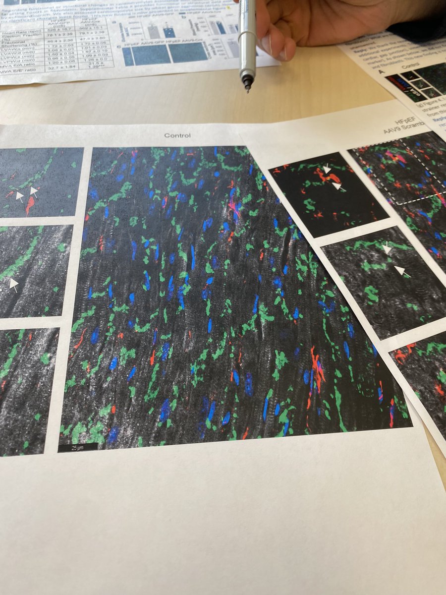 Data review with @ThassioMesquita and @EugenioCingolan. Sometimes the #data are compelling not only in their quality, but also in their beauty! @SmidtHeart @CedarsSinaiMed #EPeeps