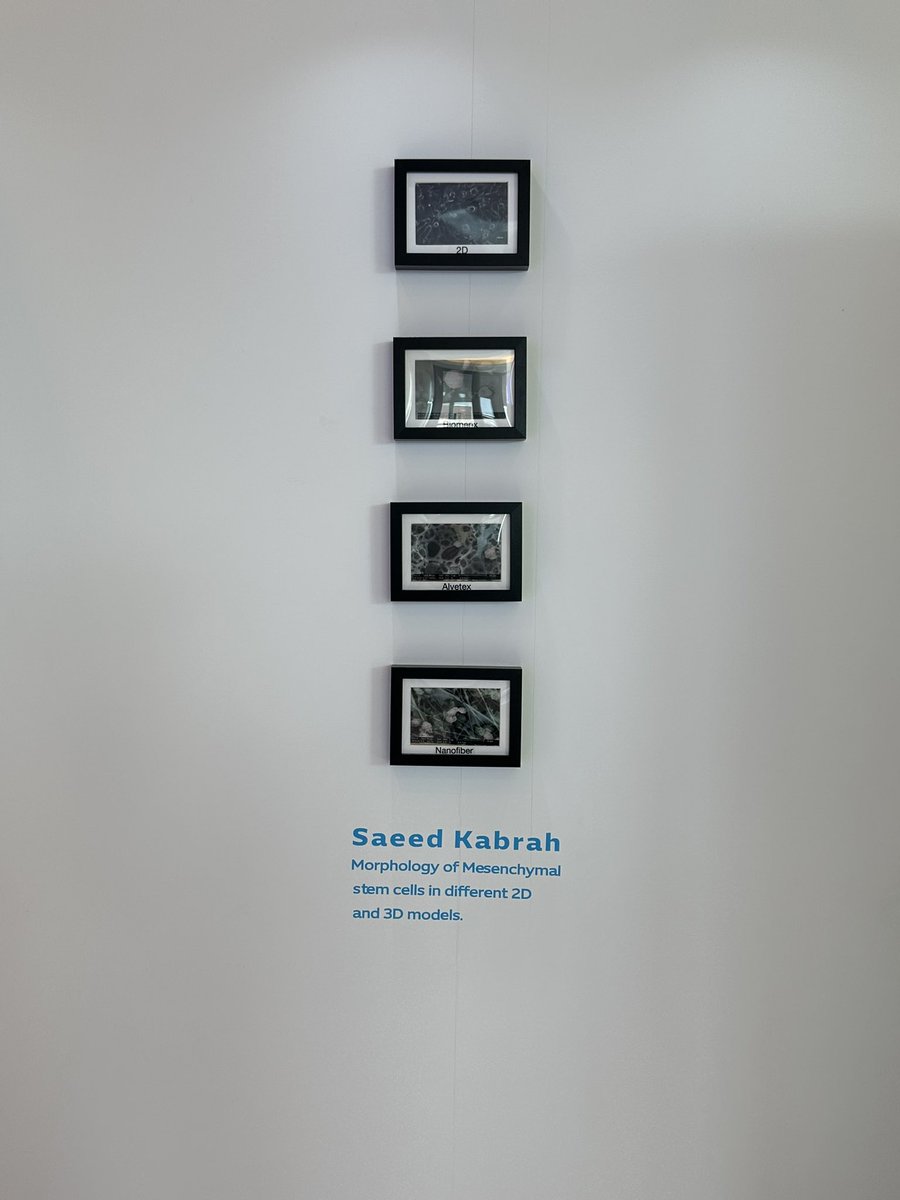 SmKabrah's tweet photo. سُعدت بمشاركتي في مؤتمر احدث التطورات والابتكارات في المختبرات الطبية الذي ينظمه مركز الخدمات الصحية المساندة بوزارة الصحة في مسابقة #Lablense المصاحبة للمؤتمر #TIML من خلال صورتي بعنوان 
أشكال الخلايا الجذعية باستخدام المجهر الإلكتروني 
#TrendsInMedicine #MedLabInnovation https://t.co/sHYYJhY0x5