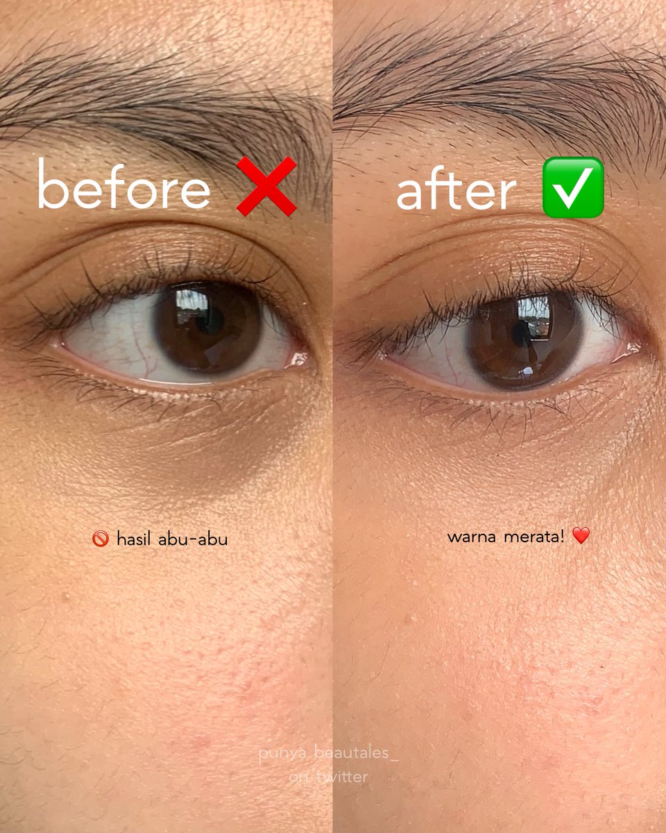 “DUH UNDEREYE AKU ABU ABU KALO PAKE CONCEALER 😭” sini sini aku ajarin biar hasilnya gak abu abu! beginner friendly 💯 tutorial lengkap di bawah ⤵️