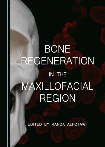 Bone Regeneration in the Maxillofacial Region, 1st Edition - E-Book - Original PDF
Authors: Randa Alfotawi
Publication: Cambridge Scholars Publishing (August 1, 2023)
Year: 2023
ISBN: 9781527517028, 9781527517035
Format: Original PDF
Language:

medicalebooks.org/shop/bone-rege…