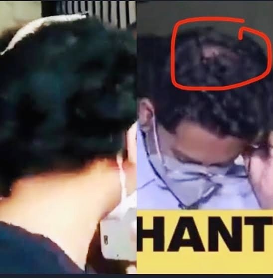 📌How Siddharth Pithani got Head Injury just after the Demise of Sushant❓

@CBIHeadquarters @arjunrammeghwal @IPS_Association @PMOIndia
@HMOIndia

SSRCase An Open Secret
#JusticeForSushant️SinghRajput