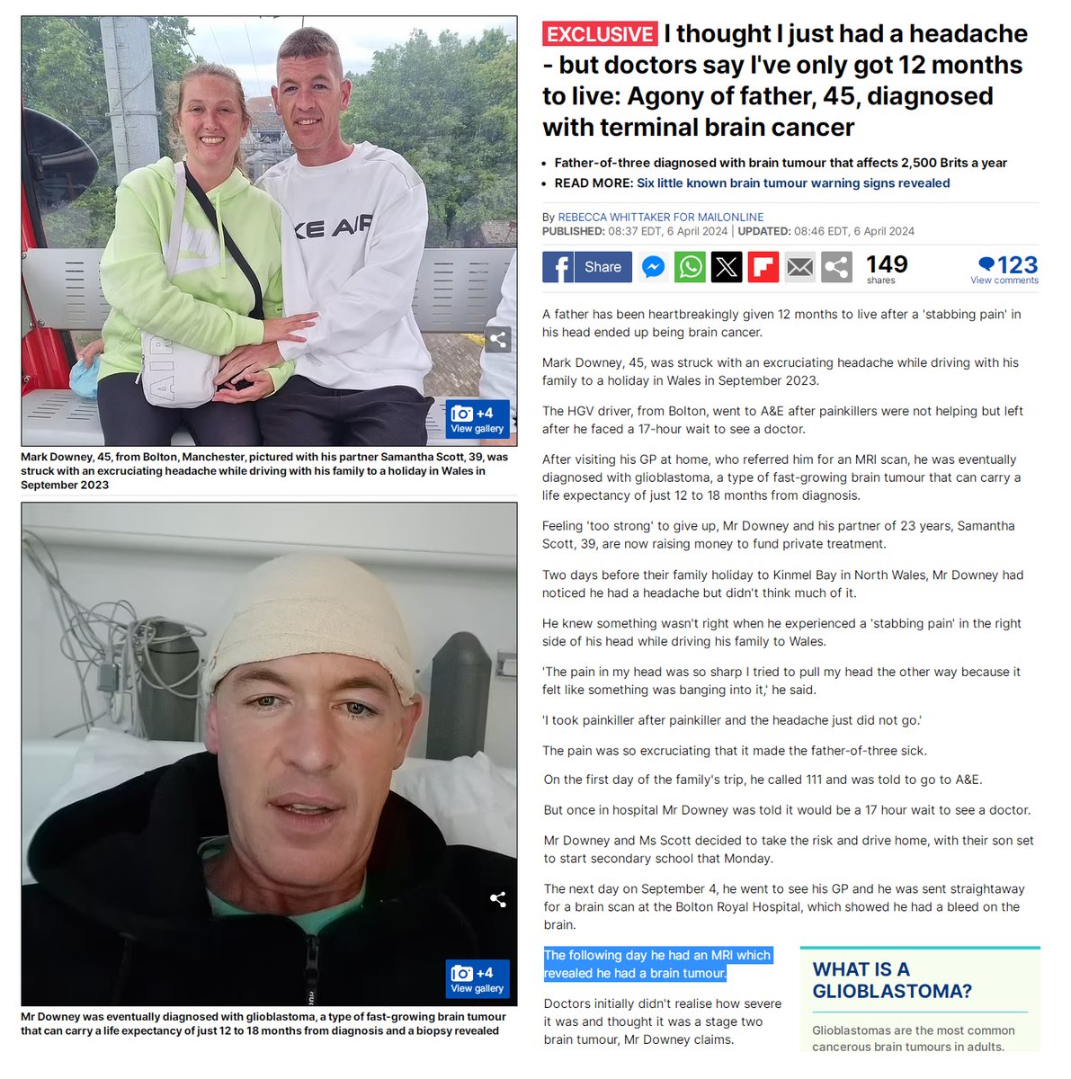 Manchester, UK - 45 year old Mark Downey had a headache while driving in Sep.2023

He was diagnosed with terminal glioblastoma.

COVID-19 mRNA Vaccine Induced Turbo Cancer cases are at an all time high.

Glioblastoma is 2nd most common mRNA Induced Turbo Cancer.

#DiedSuddenly