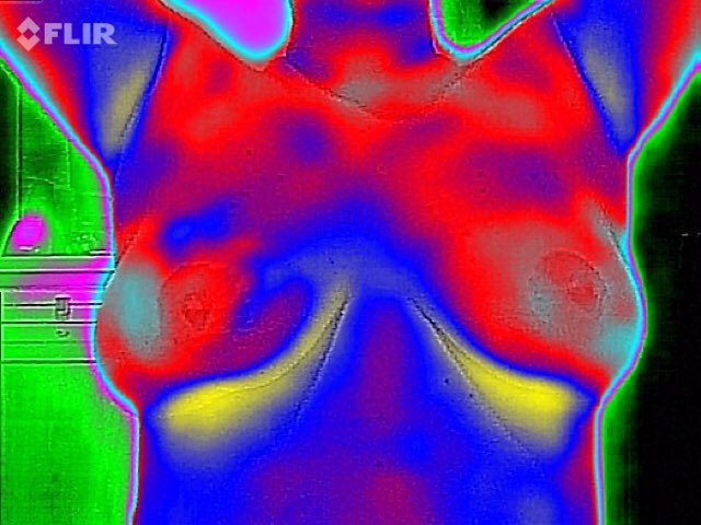 Estejam vigilantes como os guardiões da noite, cuidando de vosso corpo como o templo sagrado que é; pois aquele que atende aos primeiros sinais, protege sua vida contra as tempestades da enfermidade @InfraREDMedORG #termografia #cancerdemama #medicinapreventiva #medicinadafamilia