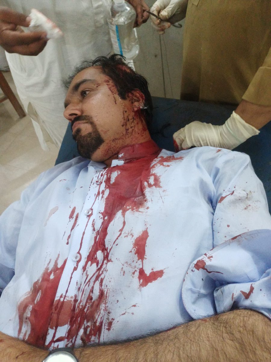 Breaking !

Journalists of Balochistan in Pakistan under attack once again !

Today unknown Armed personnel opened fire on Daily Azadi <a href="/azadi_quetta/">Daily Azadi Quetta</a> news Editor Gulzar Baloch &amp; shoib Aman advocate in Mach Balochistan !

 Balochistan Union of Journalists strongly condemned the
