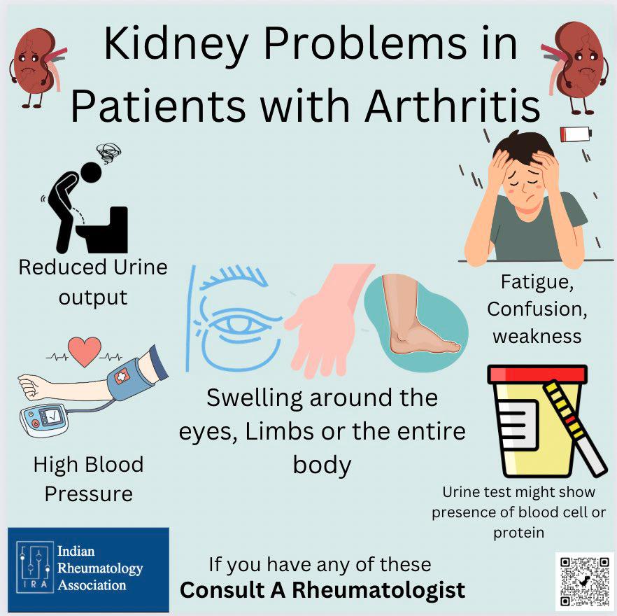 Arthritis isn't just about joints—it can impact eyes 👁️, lungs 🫁, skin, blood, kidneys, and more. 
Reach out to a Rheumatologist for expert guidance.  #KnowTheSigns
#Rheumatology #Awareness #Autoimmune #IRA