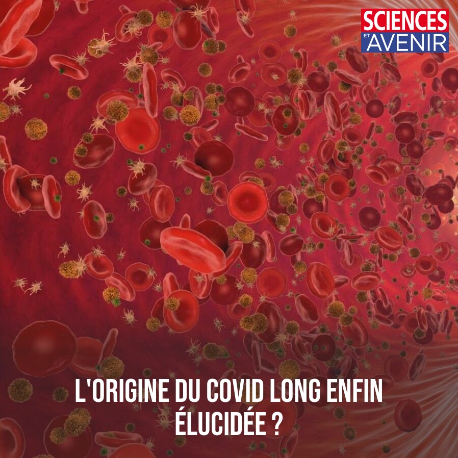 Sciences_Avenir's tweet photo. Chez les personnes souffrant de Covid long, les scientifiques ont trouvé un excès de production dans le sang d’un médiateur typique de l’inflammation, l’interféron gamma (IFNg) ! 
👉 https://t.co/dr0WiVOxIJ https://t.co/pDd1a4BpRs
