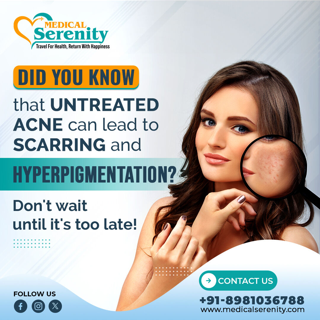 Untreated acne isn't just a temporary problem – it can leave permanent marks on your skin. Call now ☎️ to take proactive steps and treat it early to minimize the risk of scarring.

#skincare #acnetreatment #medicalserenity #medicalservices #treatment #hyperpigmentation