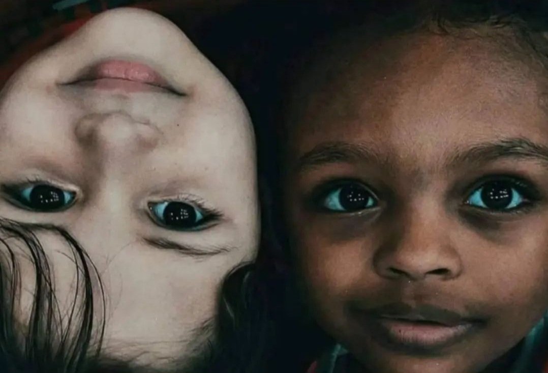 Beauty is not skin color . Everyone is beautiful in their own way.