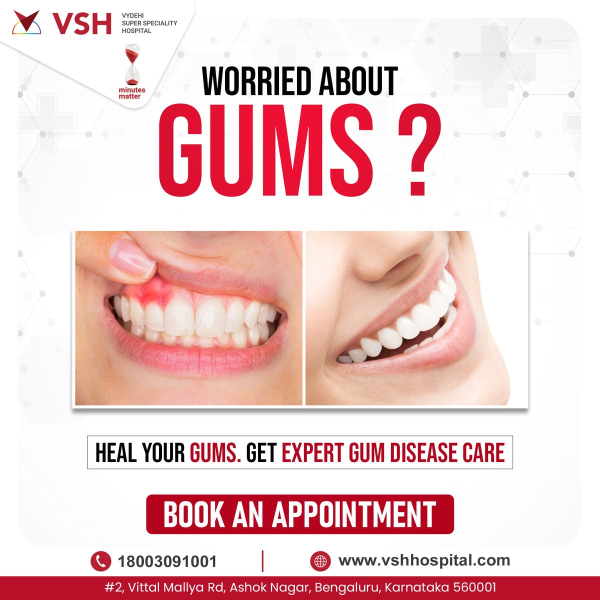 Don't let gum disease win! VSH Hospital's expert team can help you heal your gums & restore your smile. 📷  Get lasting results & a healthier you!  #GumDiseaseTreatment #dentalhealth
#safety #savelife #indianhealth #besthospitalinbangalore #superspecialityhospital #vsh