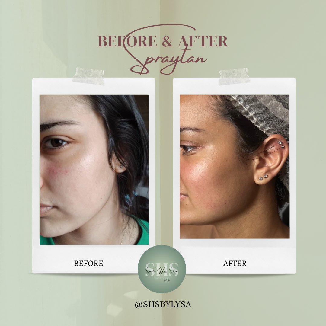 Honestlysa's tweet photo. Après avoir flopé avec l’auto bronzant action, j’ai fais mes recherches et j’ai trouvé la meilleure solution pour bronzer sans UV, j’ai beaucoup travaillé, et voilà le résultat 🥰🫶🏻 venez sur insta @shsbylysa_ #autobronzant #action #spraytan #bronzer #bronzage #uv https://t.co/go3iIrggqp