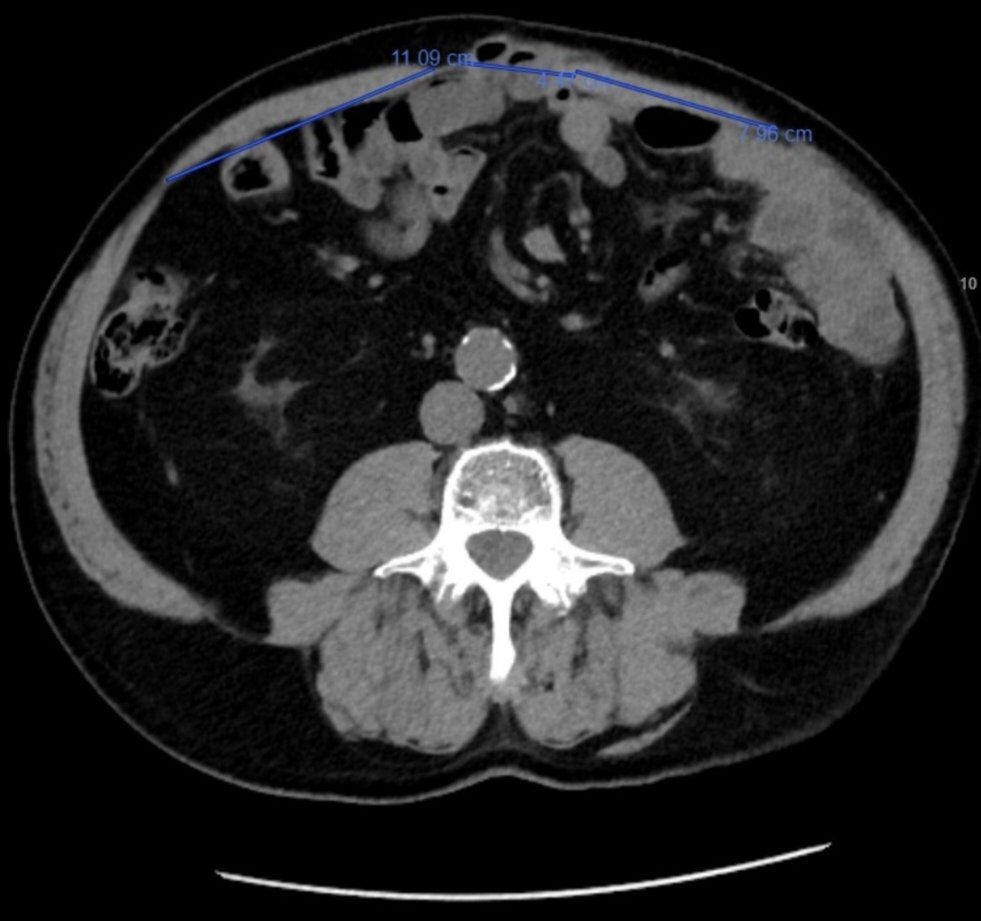 Derby Pancreaticobiliary & Robotic AWR Unit tweet media
