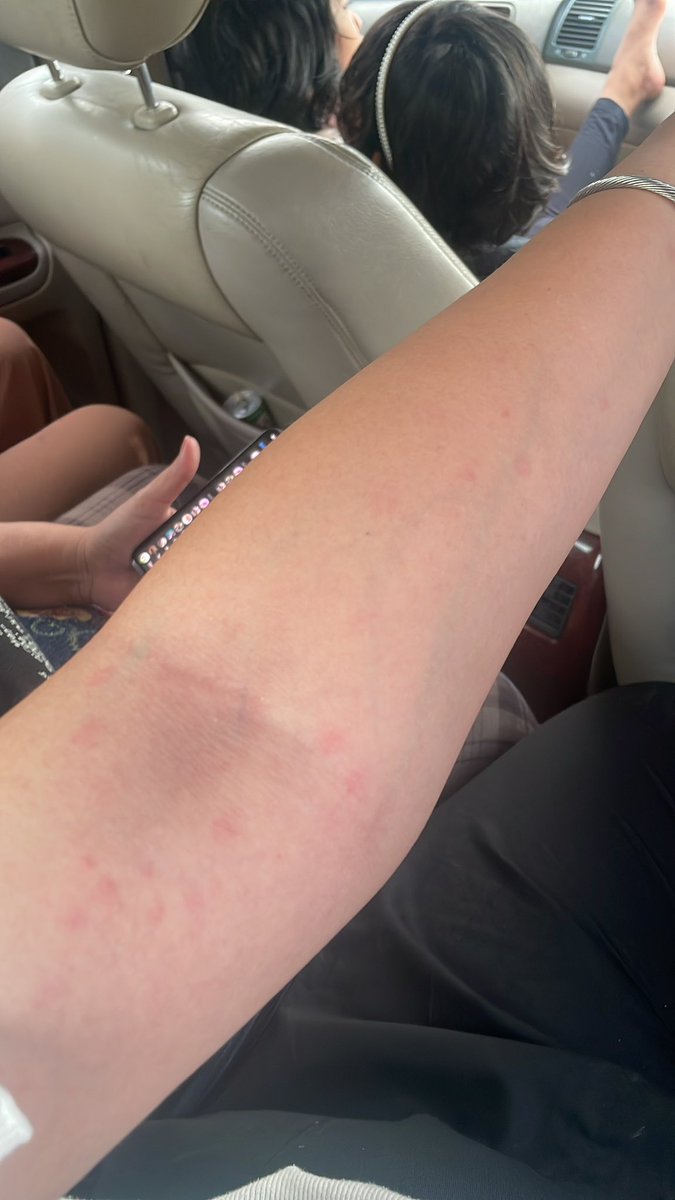 hadassaro tweet media