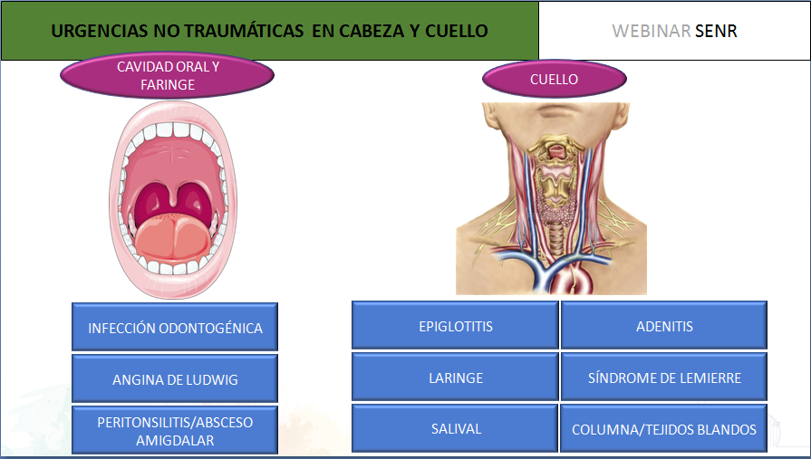 Ahí tenéis un esquema de lo que irá el Webinar de mañana! Habrá casos para que los podáis ver en casa... con la ruedita desde casa!