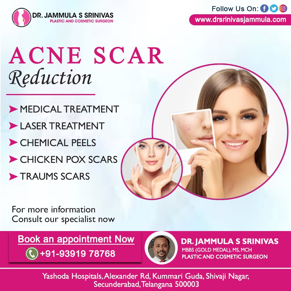 Say goodbye to #acnescars! 
Discover our revolutionary #treatment for clear, radiant #skin. Boost #confidence and #beauty. 
Visit us today!'

#drsrinivasjammula #cosmeticsurgeon #cosmeticsurgery #plasticsurgeon #plasticsurgery
#surgery #breastaugmentation #skincare #surgeon