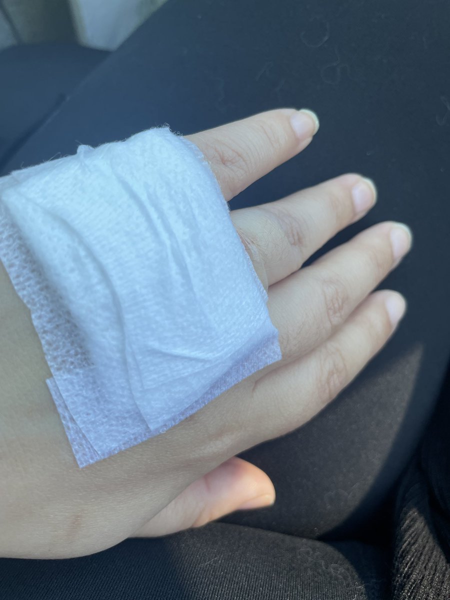 I’ve been going to the dermatologist for the past few months, had some abnormal test results and found that one of my moles was precancerous. Today one of them was removed, got 5 stitches yay 😎 let’s hope this is the end and not the start of a battle 😭