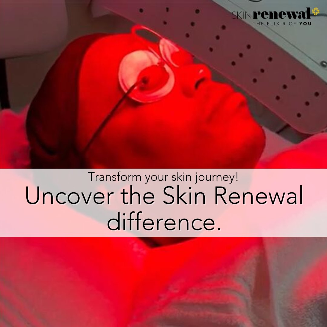 At Skin Renewal,  our unique prep routine is expertly designed to reduce inflammation & fortify your skin, making it resilient against intensive light & laser therapy tinyurl.com/yc3yr44u 
 
#SkinRenewal #FlawlessSkinPrep #LaserTherapy #LightTherapy #SkinHealth #DrLed